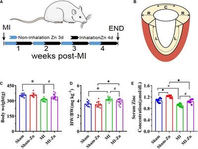 Short-Term Inhalation of Ultrafine Zinc Particles Could Alleviate Cardiac Dysfunctions in Rats of Myocardial Infarction